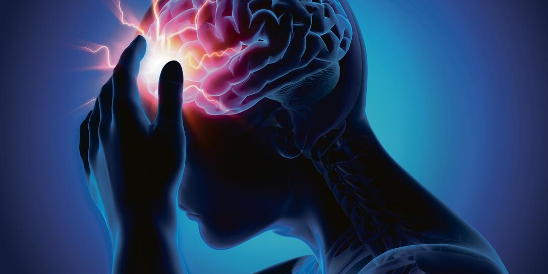 Headache-conceptual artwork-3d illustration Headache-conceptual artwork-3d illustration