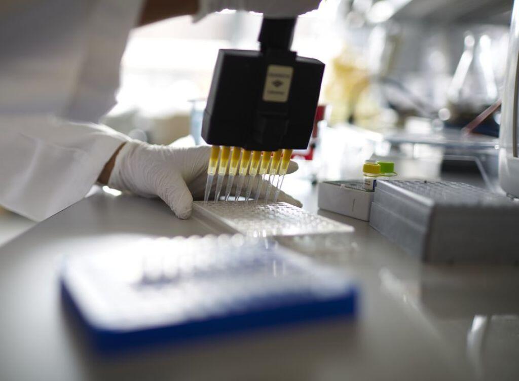 Zurzeit können HIV-Tests in der Schweiz nur im Labor durchgeführt werden, wie hier im Institut für Medizinische Virologie der Medizinischen Fakultät der Universität Zürich. (Archivbild) Zurzeit können HIV-Tests in der Schweiz nur im Labor durchgeführt werden, wie hier im Institut für Medizinische Virologie der Medizinischen Fakultät der Universität Zürich. (Archivbild)