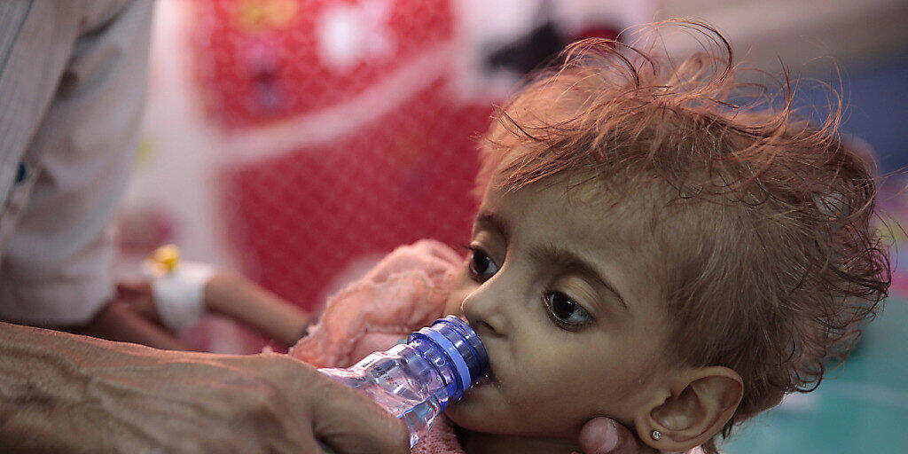 Ein Vater gibt seinem schwer unterernährten Töchterchen in einem Spital in Hodeida zu trinken. Im Hafen von Hodeida werden die meisten Importe und internationalen Hilfslieferungen für den Jemen umgeschlagen. Das Leben hunderttausender Kinder hängt davon ab. (Archivbild)