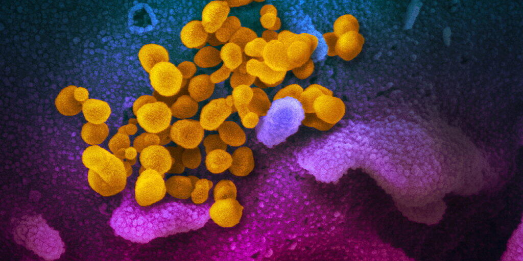 Das ist der Urheber der Lungenkrankheit: Das neuartige Coronavirus unter dem Mikroskop.