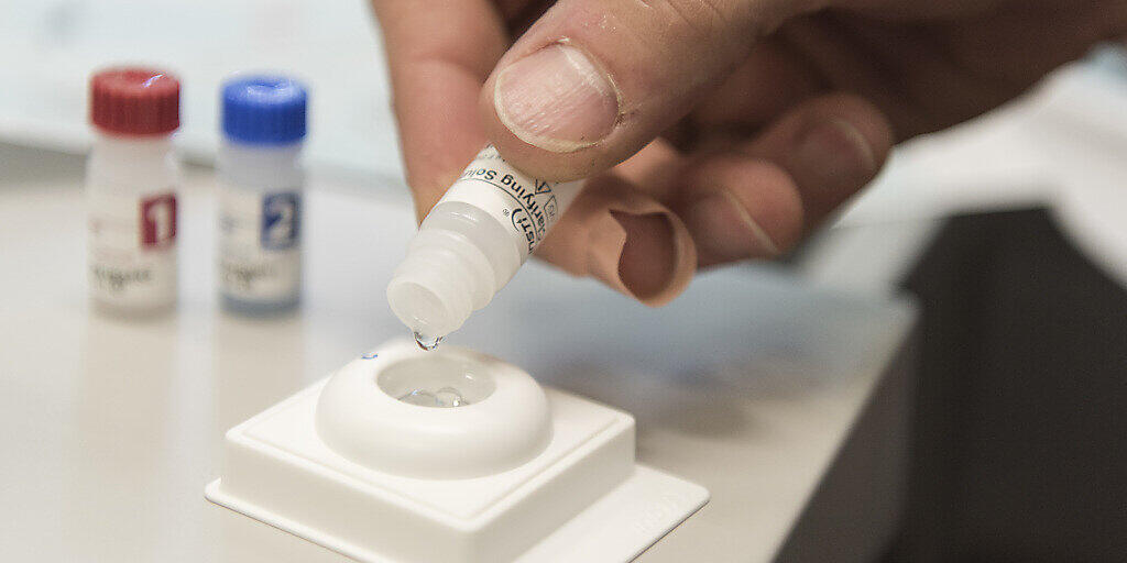 Ein Mann macht einen HIV-Selbsttest: Aids ist heute gemäss der Aids-Hilfe Schweiz soweit therapierbar, dass sowohl im Alltag wie auch beim Sex keine Ansteckungsgefahr besteht. (Archivbild) Ein Mann macht einen HIV-Selbsttest: Aids ist heute gemäss der Aids-Hilfe Schweiz soweit therapierbar, dass sowohl im Alltag wie auch beim Sex keine Ansteckungsgefahr besteht. (Archivbild)