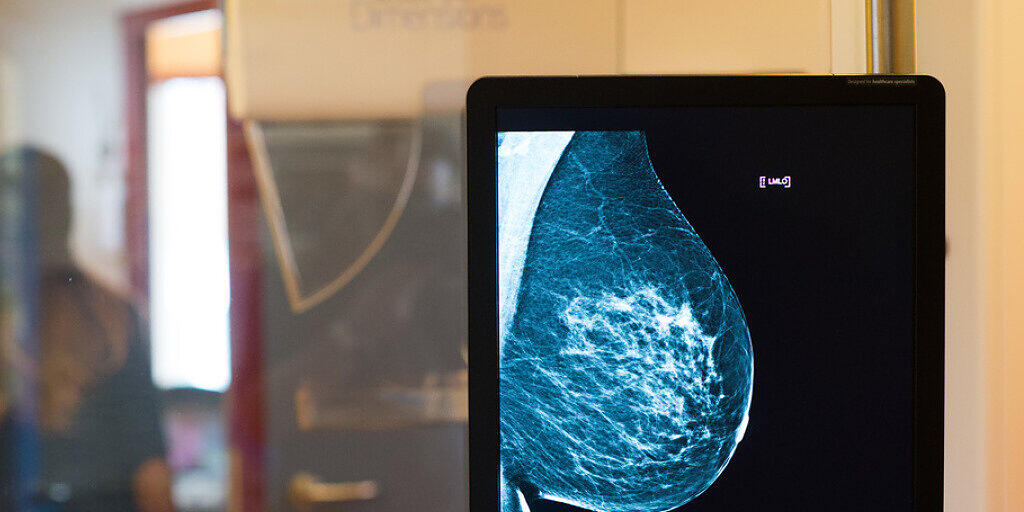 Sensible Daten aus Mammographie-Screenings oder anderen medizinischen Untersuchungen sind auf ungeschützten Servern gelandet und damit frei zugänglich. (Archivbild)
